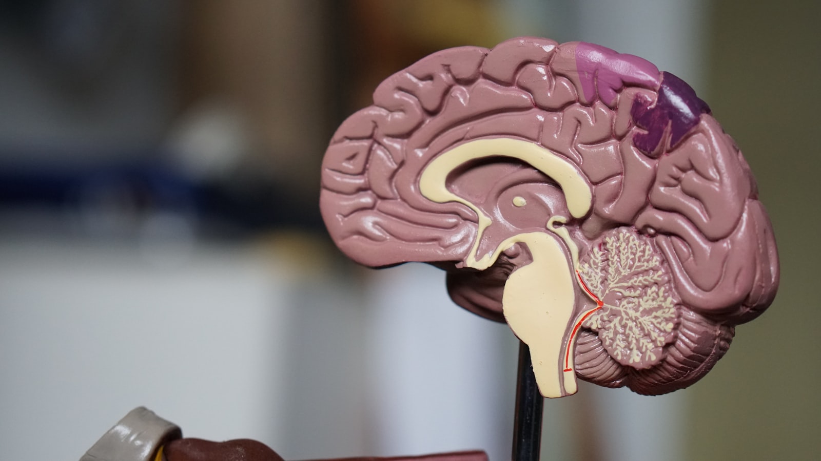 Brain Injury Compensation in 2026: Understanding Long-Term Costs and Settlement Values
